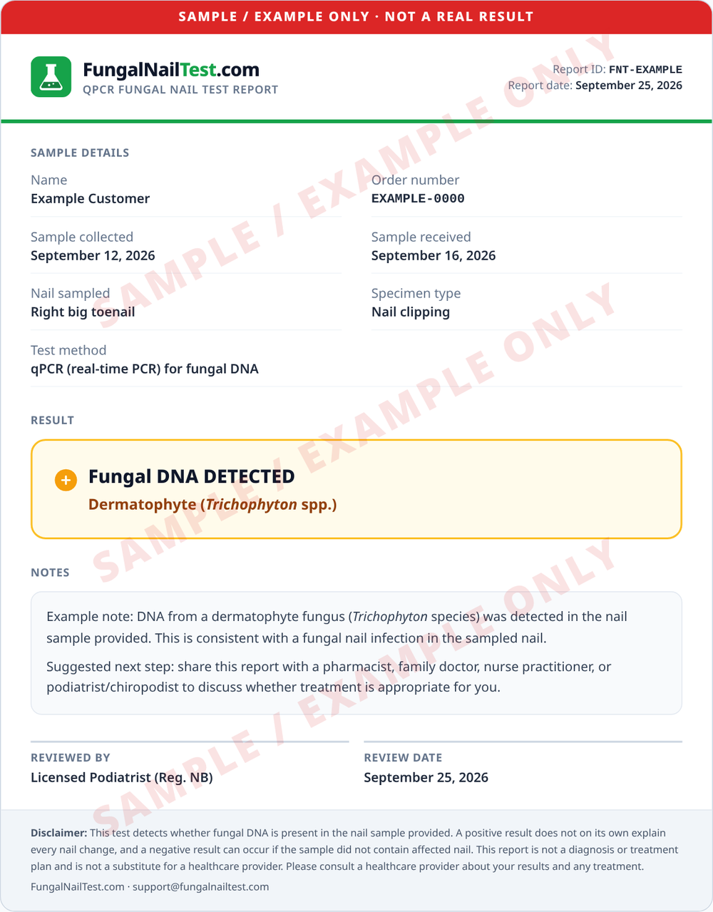 Exemple de rapport FungalNailTest.com, filigrané SAMPLE / EXAMPLE ONLY (exemple seulement), montrant le résultat : ADN fongique DÉTECTÉ, dermatophyte (Trichophyton spp.)